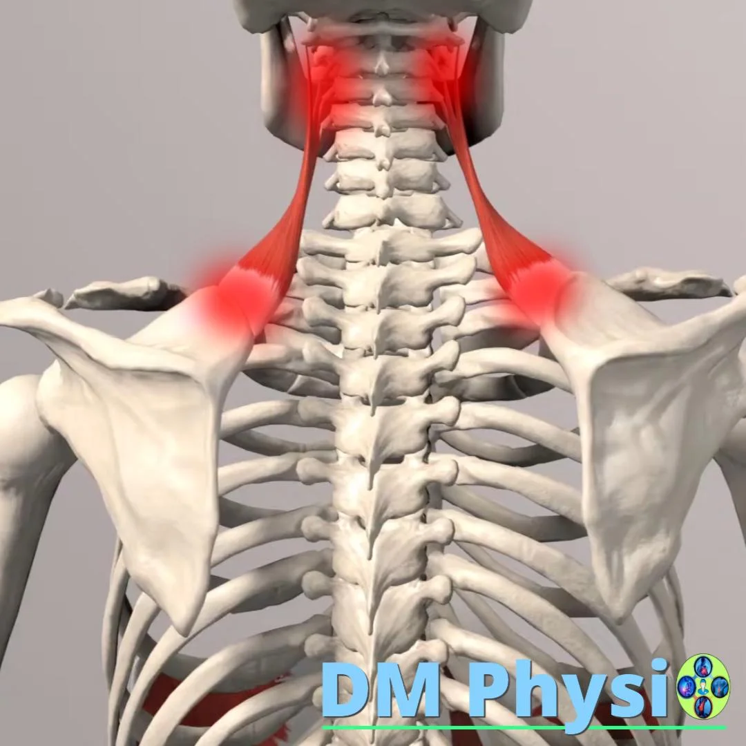 Изображение на мускула повдигач на лопатката
